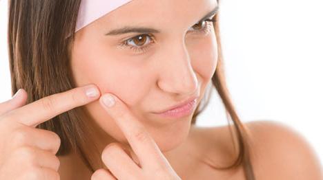 menghilangkan jerawat